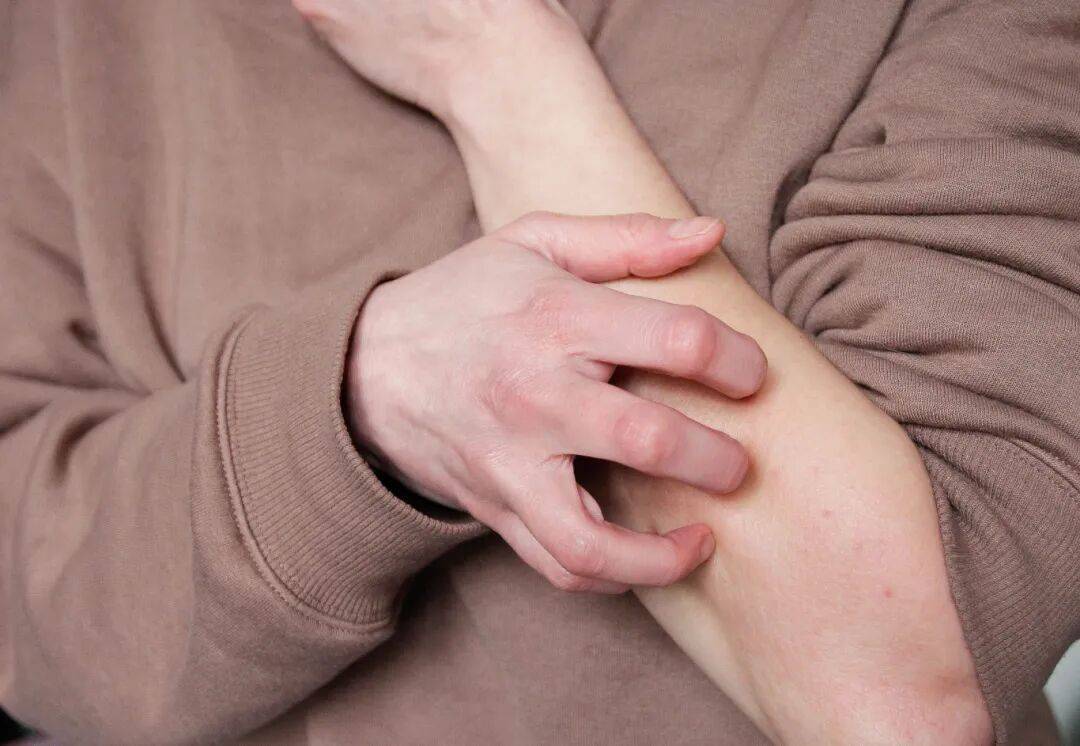 事发上海街头!女子突然浑身肿胀,陷入昏迷...医生:建议随身携带肾上腺激素笔